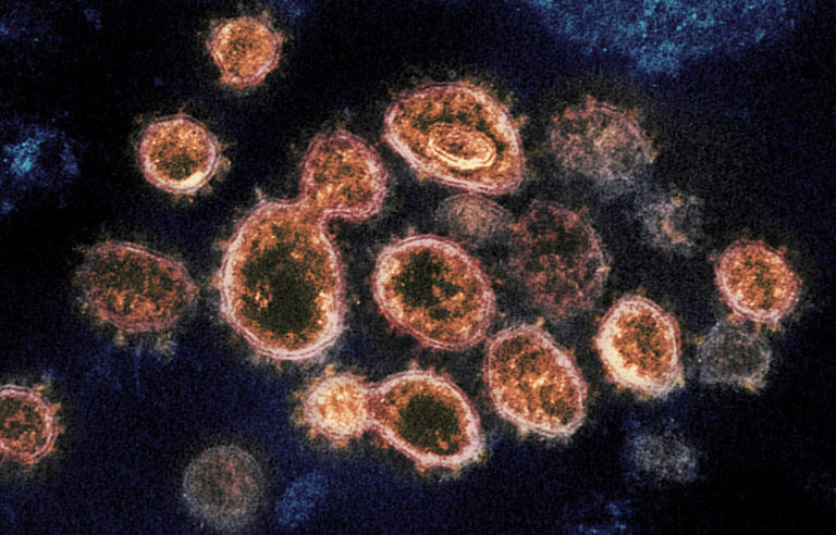Internationell expertis: Tiotals miljoner kan dö av coronaviruset