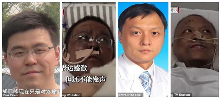 Kinesiska läkare blev mörkare i hyn av Covid-19 behandling